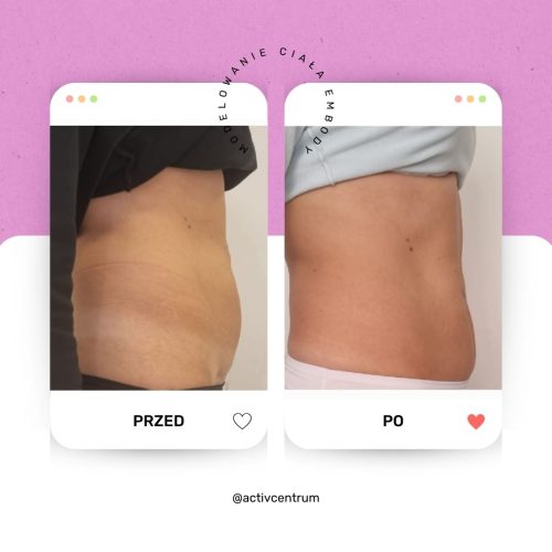 Embody Włocławek PRZED PO