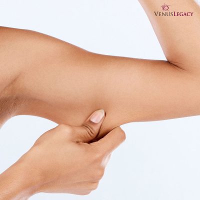 Venus Legacy na ramiona