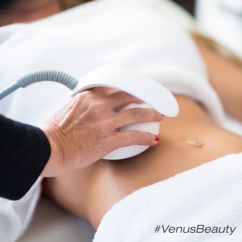 Venus Legacy zabieg antycellulitowy na brzuch ACTIV Centrum